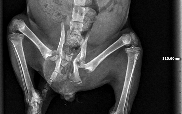 Zdjęcie rentgenowskie stawu biodrowego, z widocznymi zmianami.
