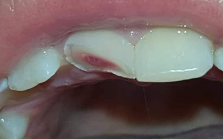 Zbiórka na operacje zęba... - zdjęcie główne