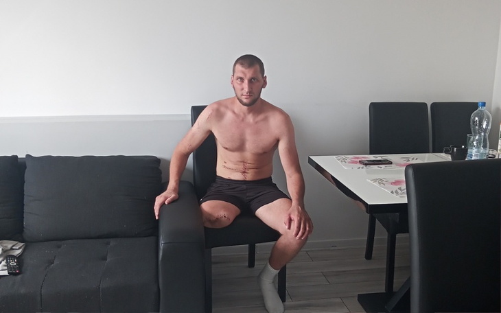 Mężczyzna siedzący na kanapie, z widocznymi bliznami na ciele.