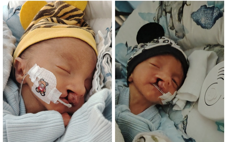 Noworodki z problemami zdrowotnymi, potrzebujące wsparcia.