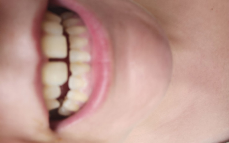 Zbiórka Nowy uśmiech 111 - zdjęcie główne