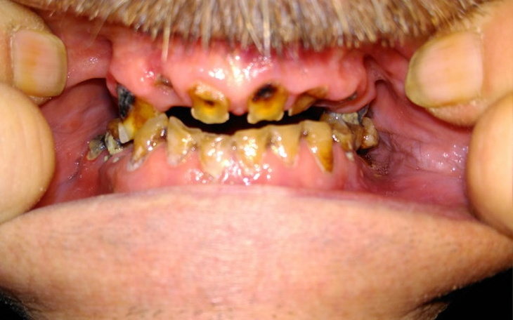 Zbiórka Na nową"klawiaturę" - zdjęcie główne