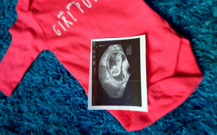 Zbiórka Pomoc dla młodej przyszłej matki - zdjęcie główne