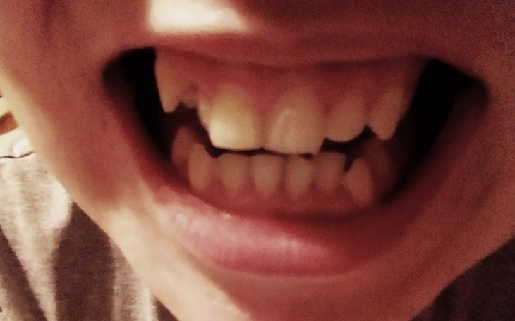 Zbiórka Leczenie największego kompleksu - zdjęcie główne