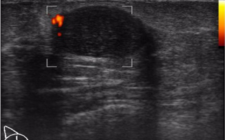 Zbiórka Walka z guzem :( - zdjęcie główne