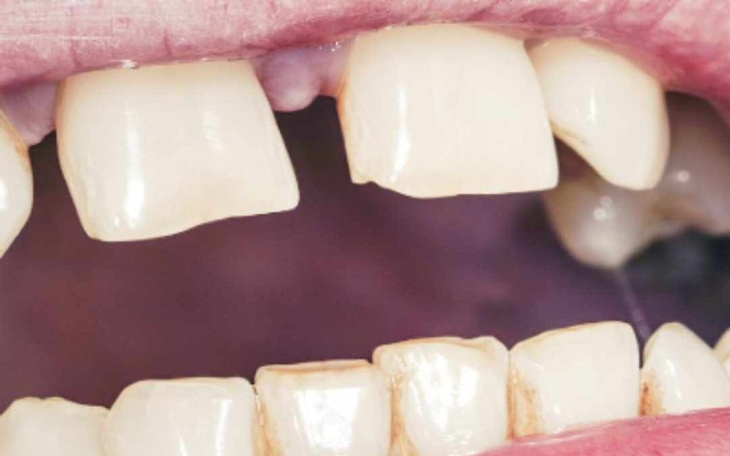 Zbiórka Zdrowy uśmiech Aparat dla Oliwi - zdjęcie główne