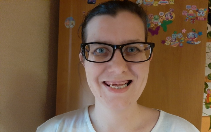 Zbiórka Zdrowy Uśmiech dla Kasi - zdjęcie główne