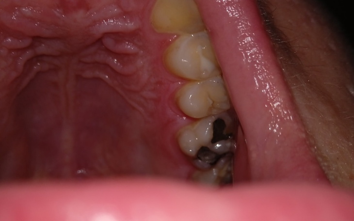 Zbiórka Na dentystę... - zdjęcie główne