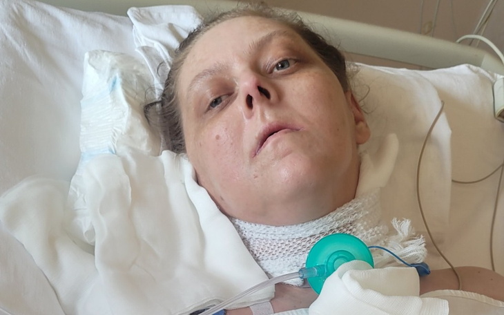 Zbiórka 6-miesięczny turnus rehabilitacy - zdjęcie główne