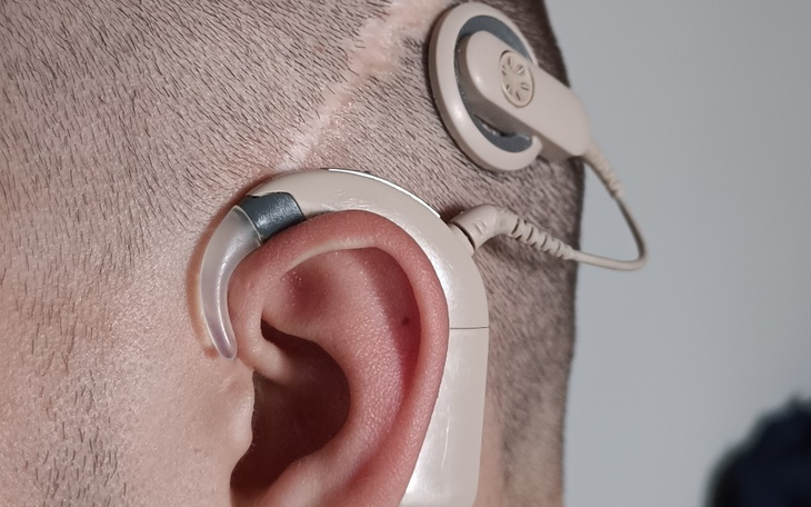 Zbiórka Naprawa procesora mowy dźwięku - zdjęcie główne