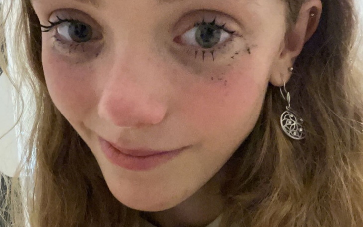 Zbiórka Na pomoc w walce z anoreksją - zdjęcie główne