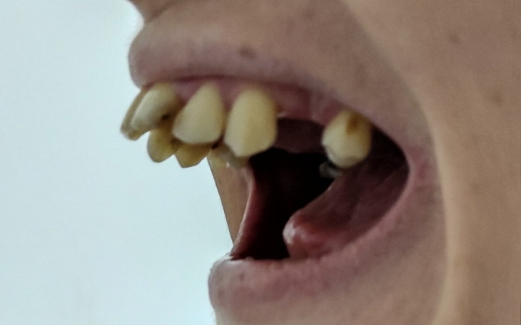 Zbiórka Na leczenie stomatologiczne- - zdjęcie główne