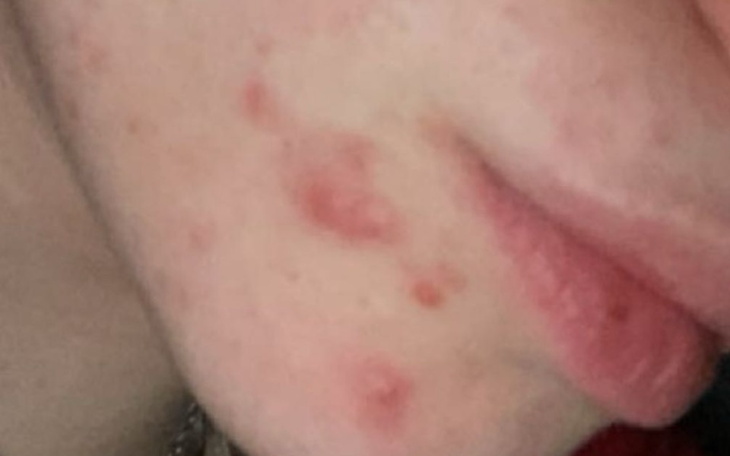 Zbiórka Trądzik - zdjęcie główne