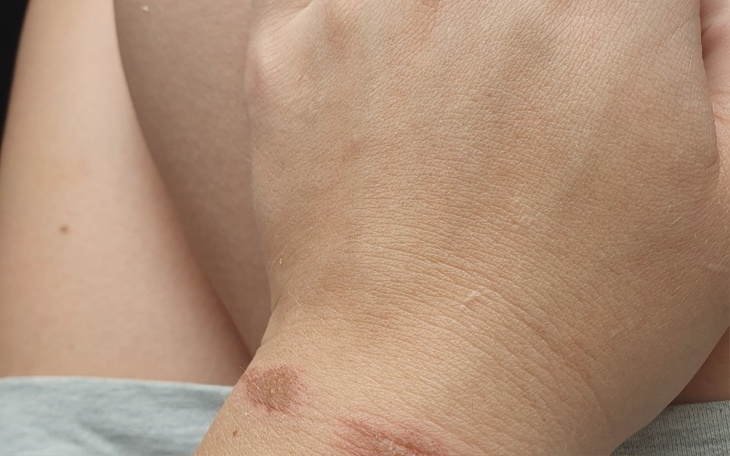 Zbiórka Zacząć na nowo po rozwodzie - zdjęcie główne