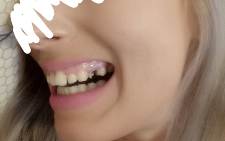 Zbiórka Zbieram na zęba proszę o pomoc - zdjęcie główne