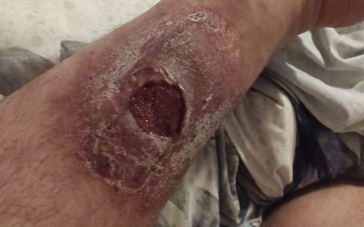 Zbiórka Zbieram na bardzo drogie leki - zdjęcie główne