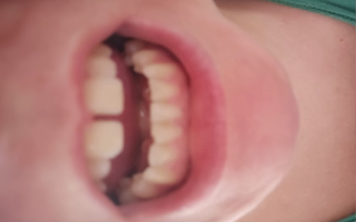 Zbiórka Piękny usmiech - zdjęcie główne