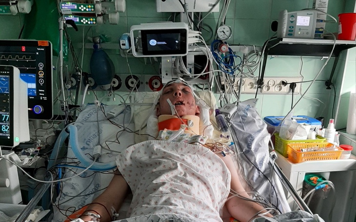 Osoba w szpitalu z wieloma urządzeniami medycznymi.