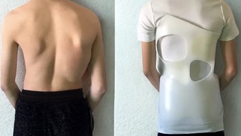 Zbiórka Gorset - moja siła! - miniaturka zdjęcia