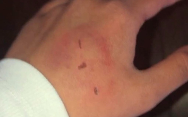 Zbiórka Potrzebny rezonans, Dżeki cierpi - zdjęcie główne