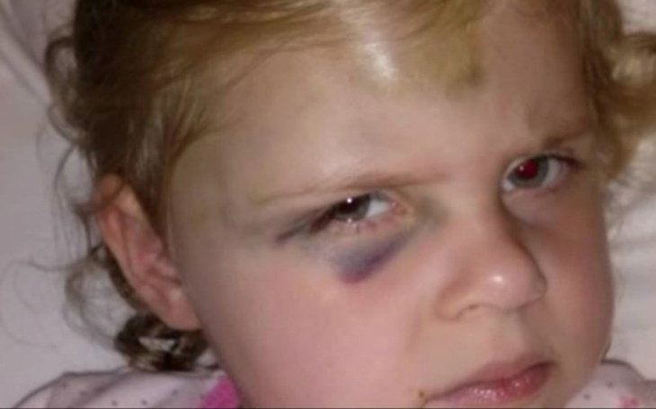 Zbiórka -Naprawić- mózg Gai - zdjęcie główne