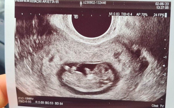 Zbiórka Na lekarzy i wyprawkę dla dzieck - zdjęcie główne