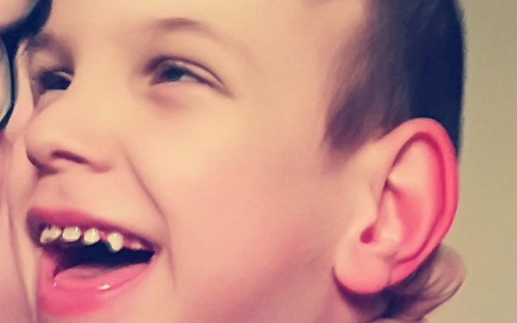 Zbiórka Stanę na nogi pokonam ból srogi! - zdjęcie główne