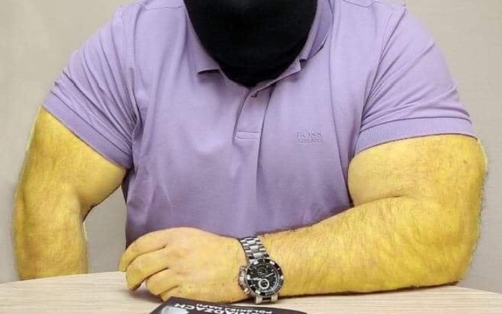 Zbiórka Antybiotyk na poparzenia skóry - zdjęcie główne