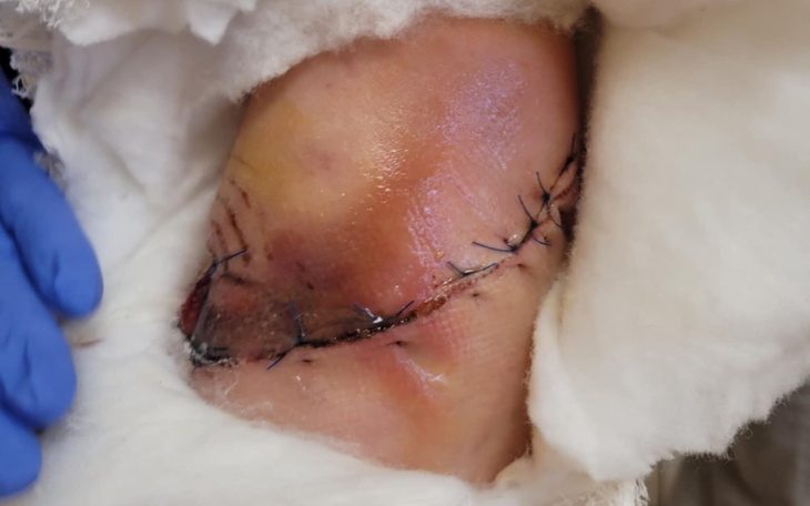 Zbiórka Dla mamy po wypadku pomoc - zdjęcie główne