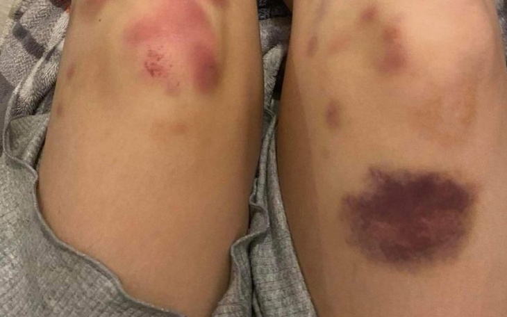 Zbiórka na Ochronę podczas Marszu - zdjęcie główne