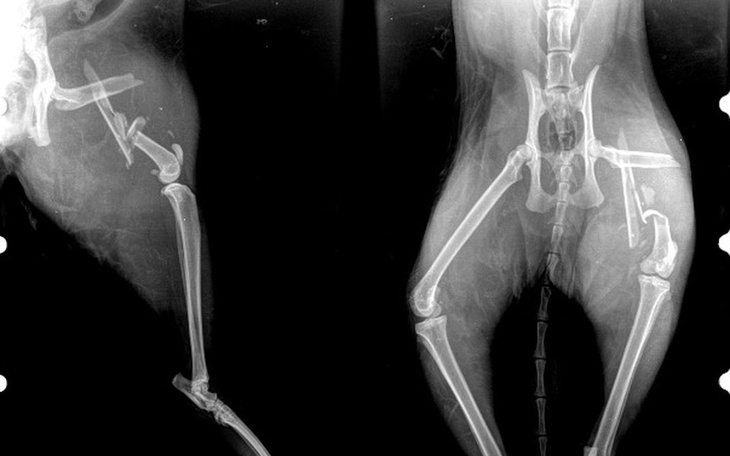 Zbiórka skomplikowane złamanie leczenie - zdjęcie główne