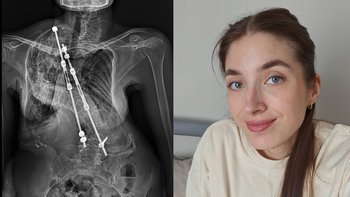 Zbiórka Leczenie w Nowym Jorku - miniaturka zdjęcia