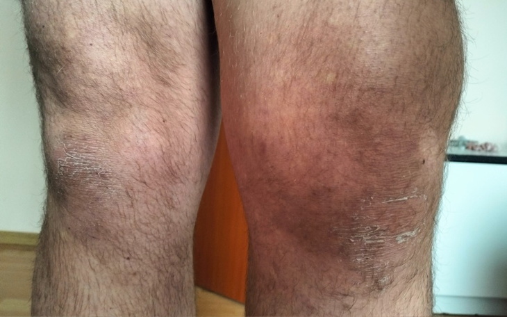 Zbiórka chciałbym znów cieszyć się pracą - zdjęcie główne