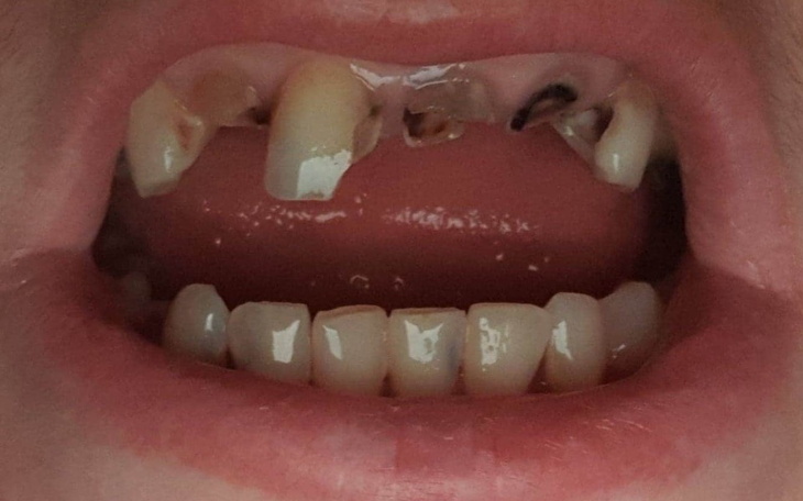 Zbiórka zbieram na moje zęby - zdjęcie główne