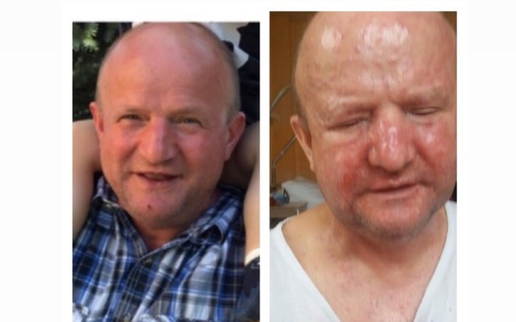 Zbiórka Uśmiech dla taty-walka z rakiem - zdjęcie główne