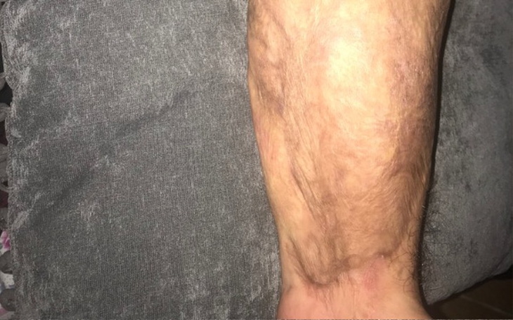 Zbiórka Operacja poparzonej ręki - zdjęcie główne