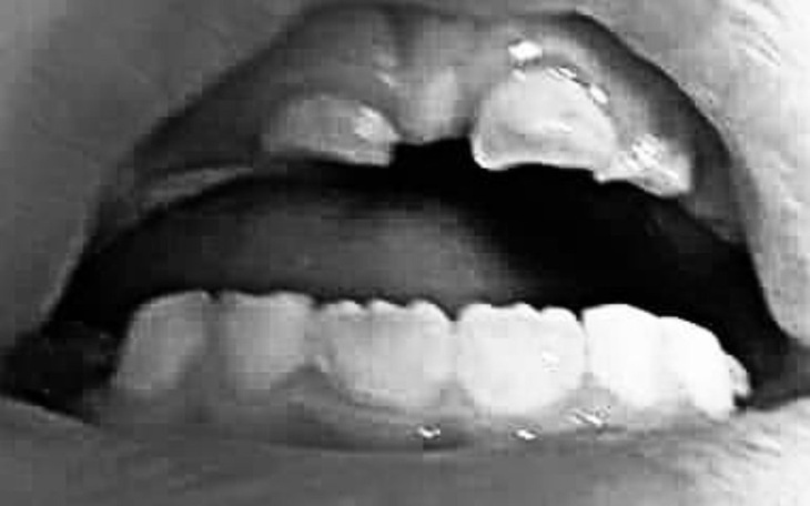 Zbiórka na ratunek zębom - zdjęcie główne