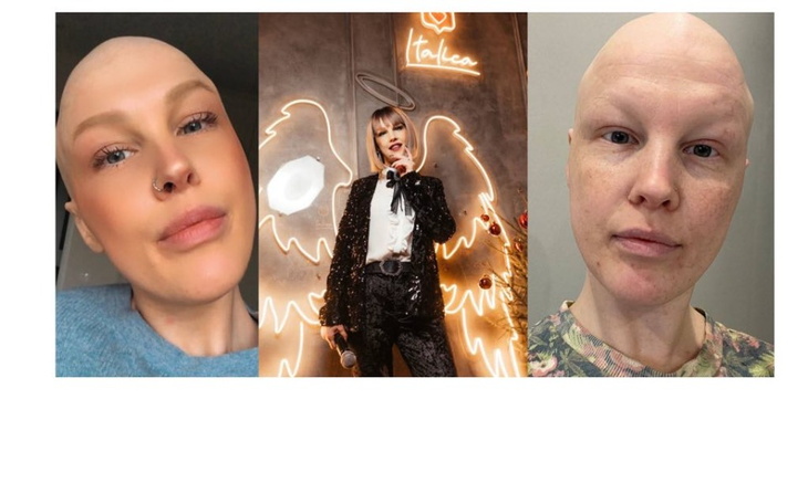 Zbiórka Remont samochodu dla Leny - zdjęcie główne