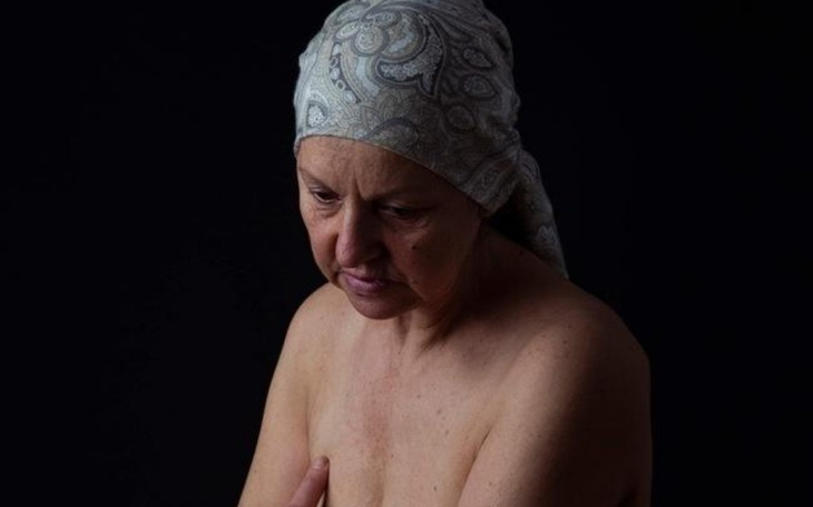 Zbiórka Nierefundowane leczenie HER2 - zdjęcie główne