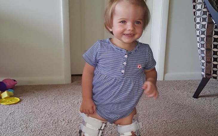 Zbiórka Pomóż Lence wyleczyć nóżki - zdjęcie główne