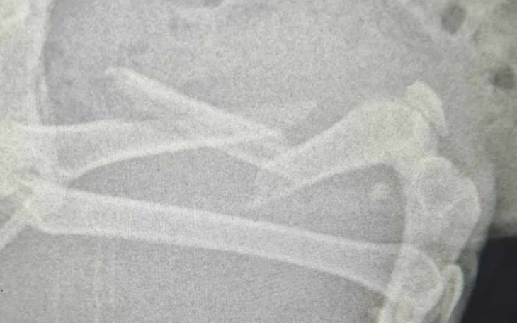 Zbiórka Operacja złamanej nogi Mufiego - zdjęcie główne