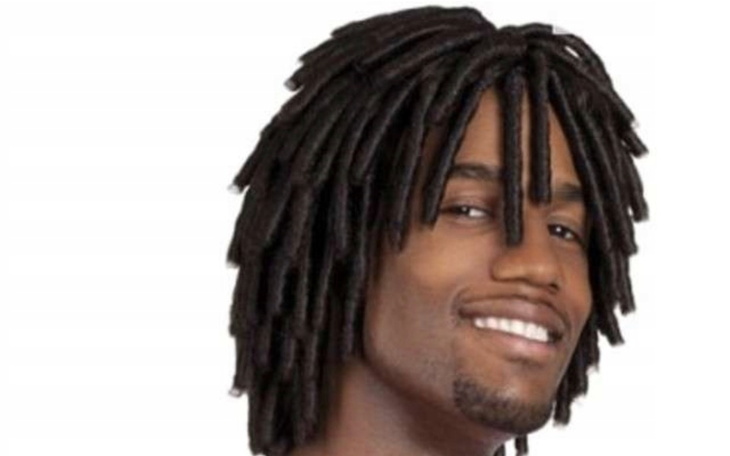 Zbiórka Przeszczep włosów - dredy - zdjęcie główne