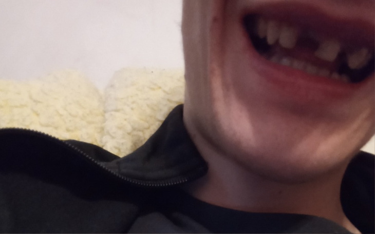 Zbiórka Na nowe zęby dla młodszego brata - zdjęcie główne