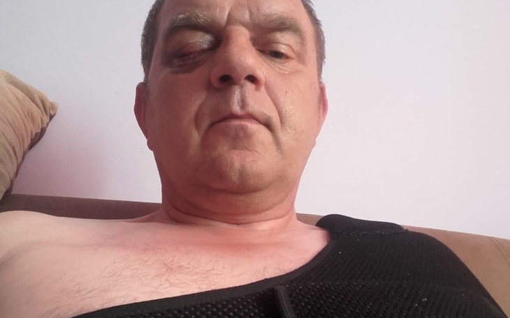 Zbiórka Operacja oka i operacja barku - zdjęcie główne