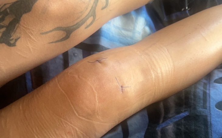 Zbiórka Na okres pooperacyjny - zdjęcie główne