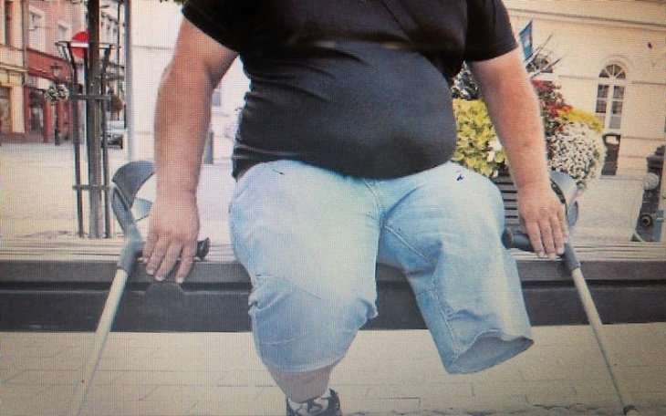 Zbiórka Z bieram dla znajomego na nogę - zdjęcie główne