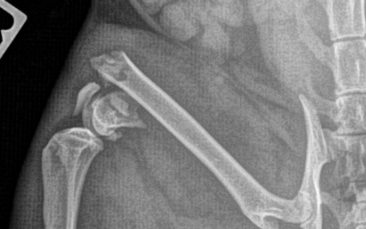 Rentgen kości, pokazujący złamanie w okolicy stawu.