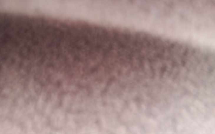 Zbiórka leki dla mojej babci - zdjęcie główne