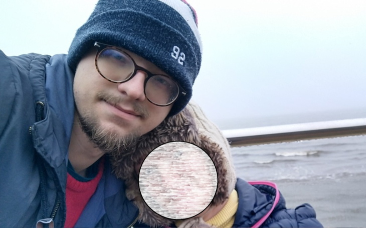 Zbiórka Pomoc w zdiagnozowaniu się - zdjęcie główne