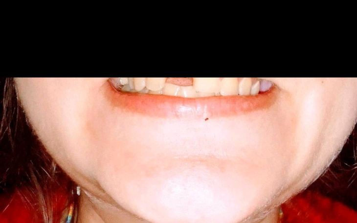 Zbiórka Na jedynkę - zdjęcie główne